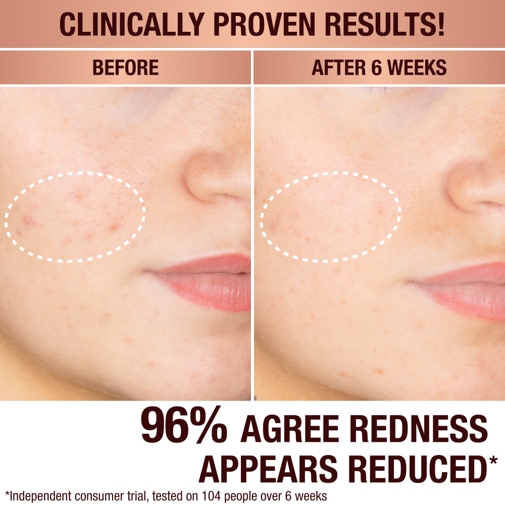 DARK SPOT CORRECTING RADIANCE RECOVERY SERUM