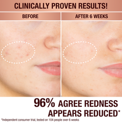 DARK SPOT CORRECTING RADIANCE RECOVERY SERUM