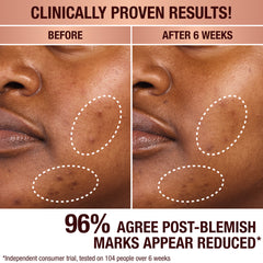 DARK SPOT CORRECTING RADIANCE RECOVERY SERUM